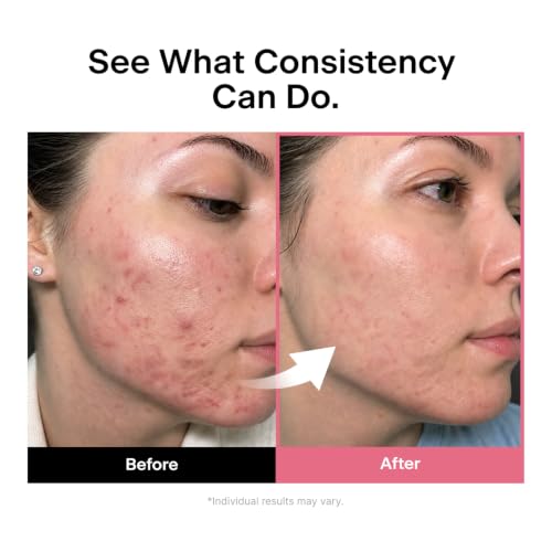 THOME Twenty Up, Clear Skin Duo Gentle At-Home Beauty Facial - Product Imagery