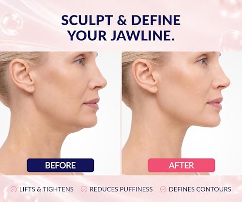 Stylia V Line Lifting Collagen Mask - Lift, Firm & Contour - Product Imagery