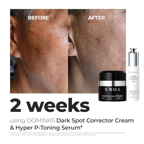 DOMINAS Dark Spot Correcting Duo - TXA Cream & Serum, Skin - Product Imagery