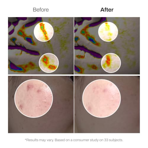 MEDITHERAPY Retinal Skin Booster Serum 5.07 fl oz | - Product Imagery