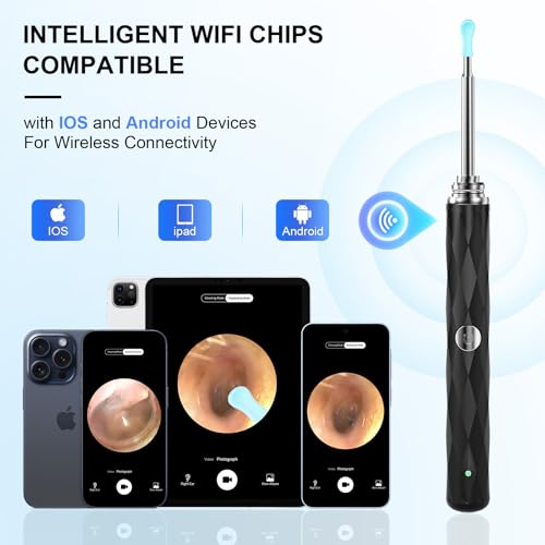 High-Definition Ear Wax Removal, Wireless Ear Cleaner, Safe and - Product Imagery