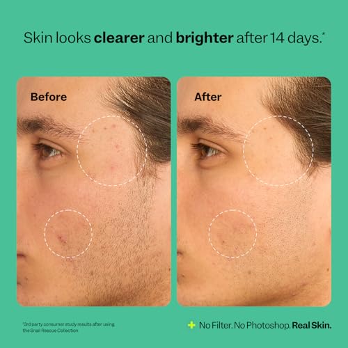 Peach Slices - Snail Rescue Blemish Busting Toner (4.05 oz) -... - Product Imagery