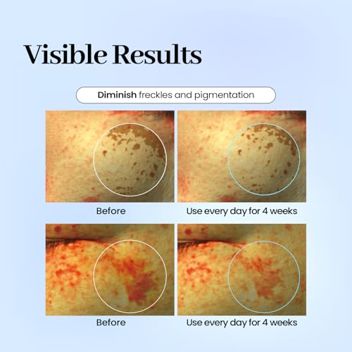 Dark Spot Care Patches – 32pcs | Labottach Korean Skincare - Product Imagery