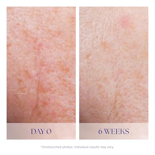 iS CLINICAL Active Serum, Helps visibly even skin tone, - Product Imagery
