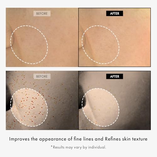 TOSOWOONG Copper Peptide 12 Cream, Anti-Aging for Fine Lines, - Product Imagery