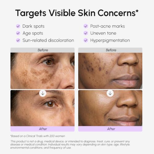 MAREE Dark Spot Remover for Face and Body – Dark Spot Corrector - Product Imagery