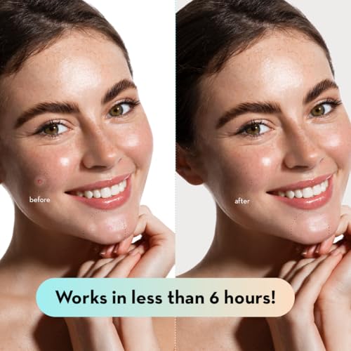 Korean Pimple Patches for Face (132 Dots) - Hydrocolloid Acne - Product Imagery