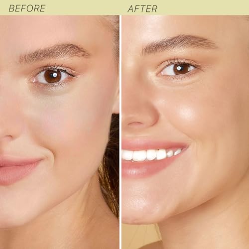 Hyaluronic Acid Moisturizer for Face - USA Made with Organic - Product Imagery