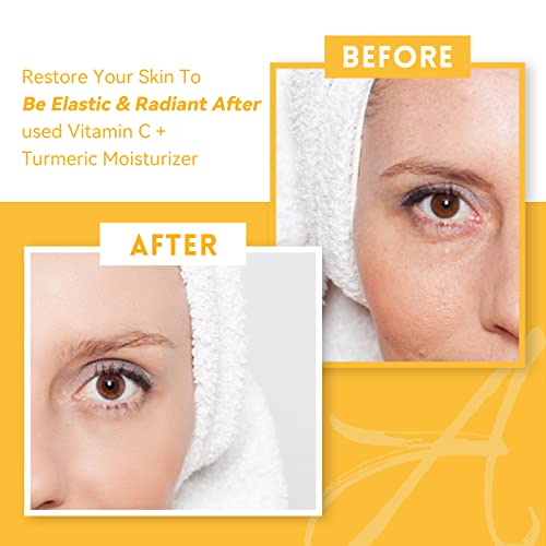 ANAI RUI Turmeric Face Cream with Vitamin C, 1.76 OZ - Product Imagery