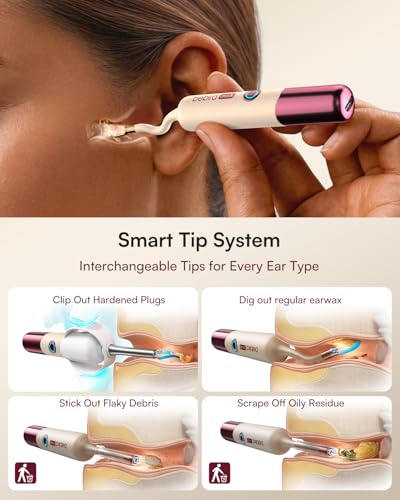 Bebird Ultra X Ear Wax Removal Kit, 4K HD Ear Cleaner Camera - Product Imagery