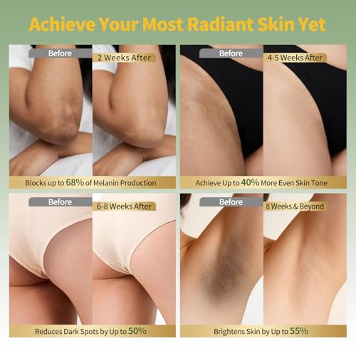 Body Dark Spot Corrector & Skin Lightening Cream for Intimate - Product Imagery