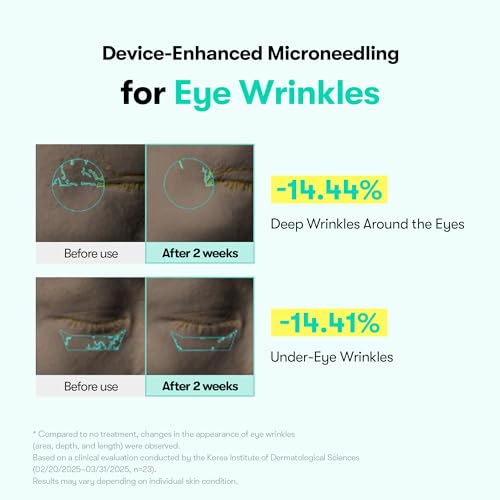 VT COSMETICS PDRN Reedle Shot Eye Cream, Vibrating Eye - Product Imagery