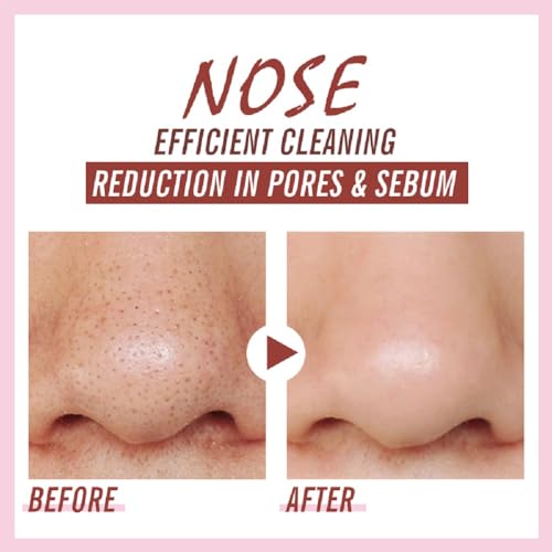 Blackhead Remover Nose Pore Strips for Women & Men, 20 PCS - Product Imagery