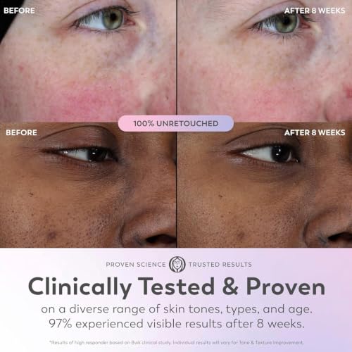 Olay Super Serum - Glow Serum for Face - Activated Niacinamide, - Product Imagery