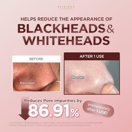 SKIN1004 [Hudson's Pick Poremizing Clay Stick Mask, Pore Care, - Product Imagery