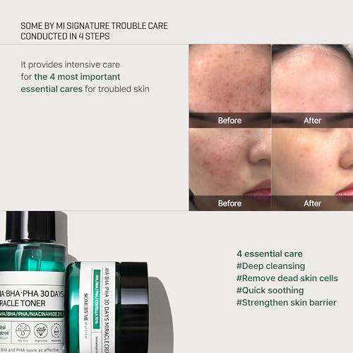 SOME BY MI AHA BHA PHA 30Days Starter Kit - Toner 1.01Oz, Serum - Product Imagery