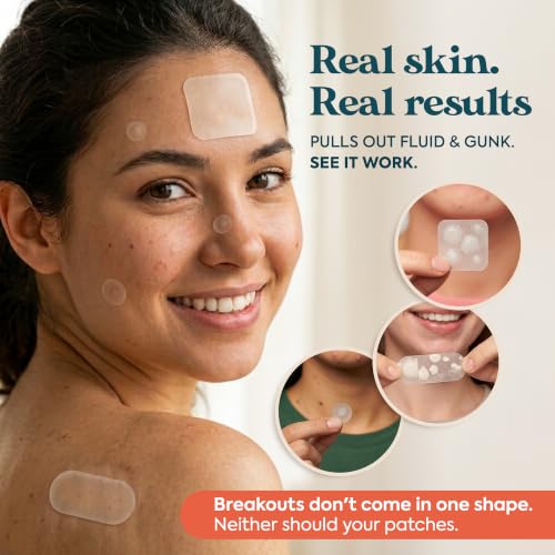 272 CT Large Pimple Patches for Face - 10 Sizes Variety Pack Zit - Product Imagery