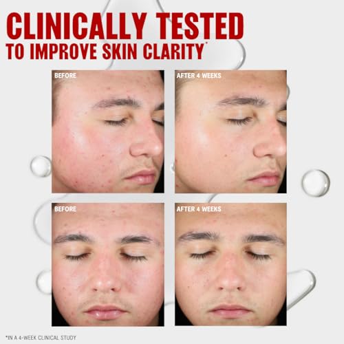Thayers Blemish Clearing Salicylic Acid Toner, Acne Treatment - Product Imagery