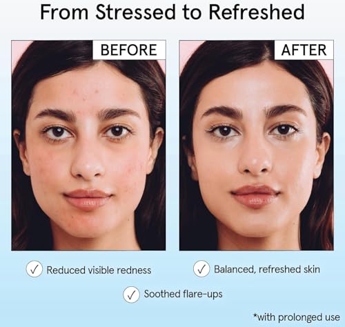 grace & stella Hypochlorous Acid Spray for Face - Body Acne - Product Imagery