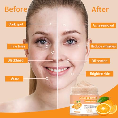 Vitamin C Face Scrub, Exfoliating Facial Wash with Retinol, - Product Imagery