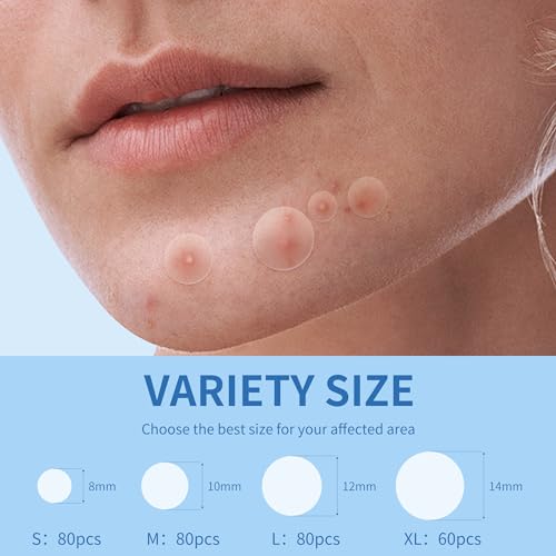 Pimple Patches for Face, 4 Size 300 Counts Hydrocolloid Acne - Product Imagery