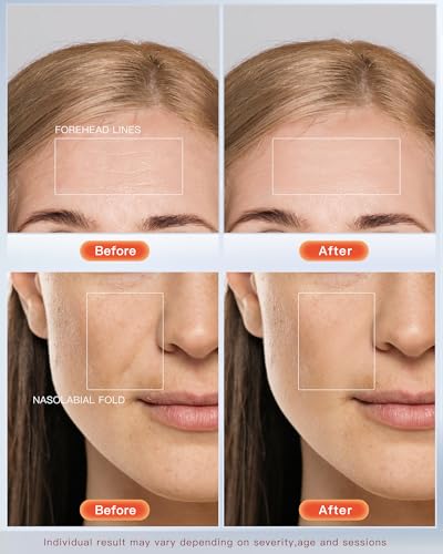 4D LED Red Light Therapy Mask for Face Skin Glowing,630nm Led - Product Imagery