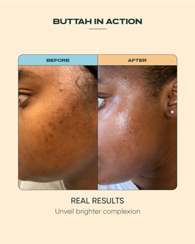 Buttah Skin 15% Vitamin C Serum 1 FL oz 30mL - For Uneven Skin - Product Imagery