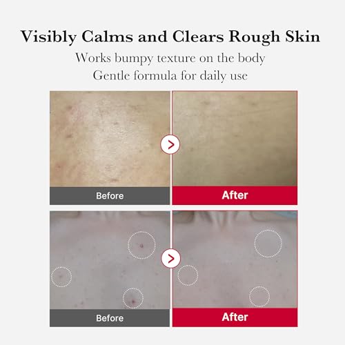 medicube Red Body Peeling Shot - AHA & BHA Exfoliating Body - Product Imagery