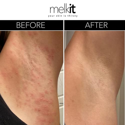 Natural Body Moisturizer Cream, Hydration for Dry or Sensitive - Product Imagery