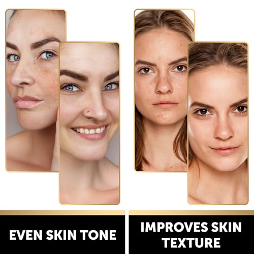 VALITIC Lemon Turmeric Soap for Dark Spots with Kojic Acid, 1 - Product Imagery