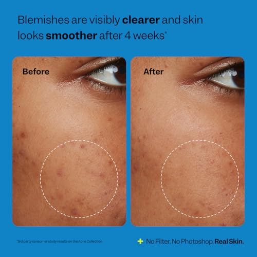 Peach Slices Oil-Free Moisturizer with 2% Salicylic Acid & - Product Imagery