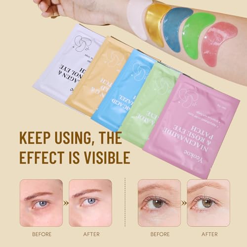 Under Eye Patches for Dark Circles,Eye Mask for Puffy Eyes With - Product Imagery