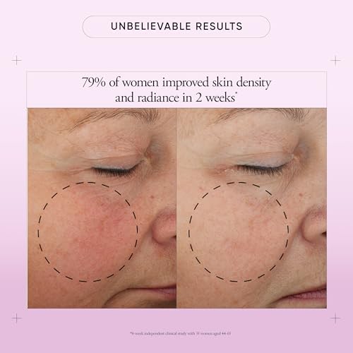 philosophy ultimate miracle worker multi-rejuvenating face - Product Imagery