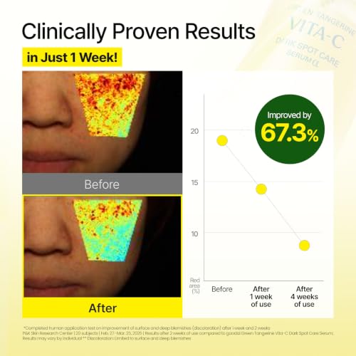 GOODAL Vitamin C Dark spot brightening Serum | 5% Niacinamide & - Product Imagery