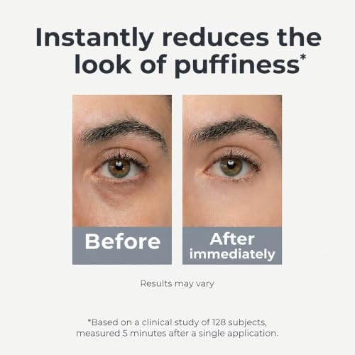 Under Eye Brightener Roller - Caffeine & Retinol Eye Serum for - Product Imagery