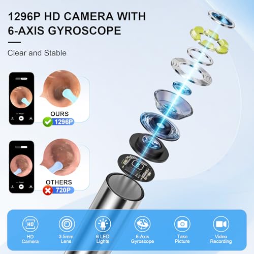 High-Definition Ear Wax Removal, Wireless Ear Cleaner, Safe and - Product Imagery