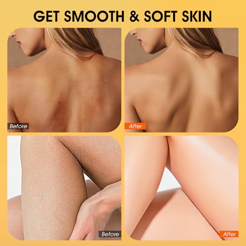 Body Scrub, Turmeric Exfoliating Body Scrub, with Coconut Oil & - Product Imagery