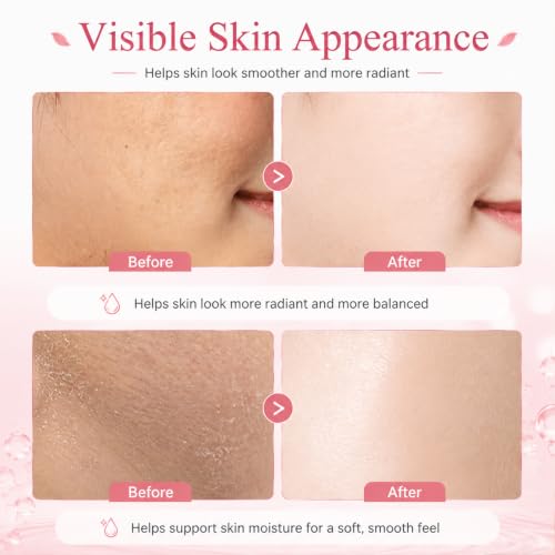 6PCS Figs Korean Skin Care Set, Moisturizing Korean Facial Kits - Product Imagery
