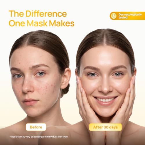 PLANTIFIQUE Korean Turmeric Clay Mask for Dark Spots - Calms, - Product Imagery