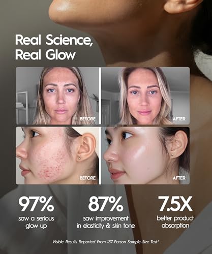 REVO Genie Facial Massager for Face and Neck, LED Beauty Device - Product Imagery