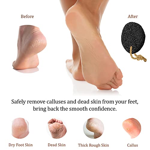 Pumice Stone for Feet - Natural Foot Scrubber for Dead Skin - Product Imagery