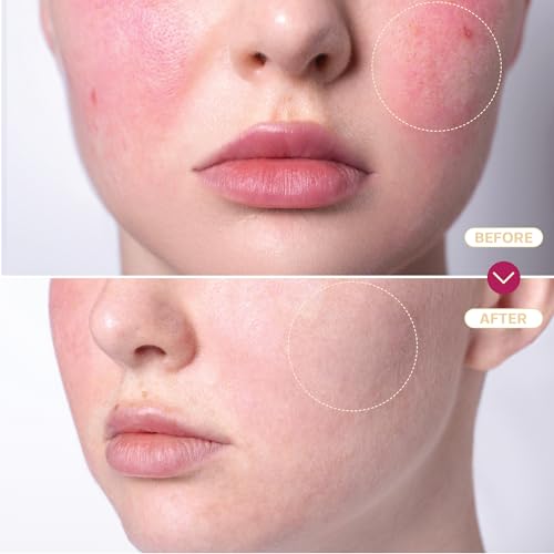 BASE LABORATORIES Hypochlorous Acid Spray for Face, Skin Cleanse - Product Imagery