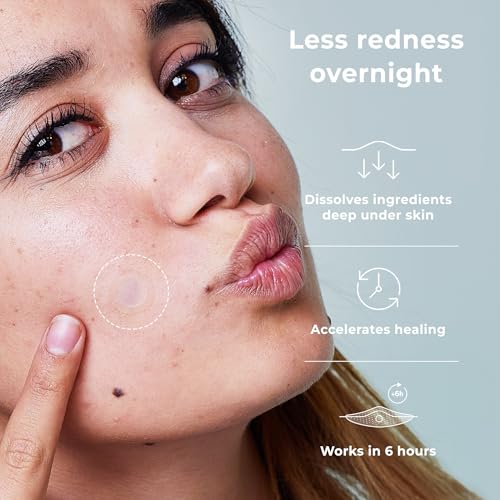 OMMA Korean Microdart Acne Patch, Cystic Acne Treatment, - Product Imagery