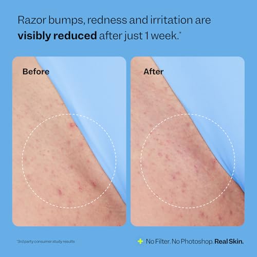 Peach Slices - Smoothing Solution Ingrown Hair Treatment (1.69 - Product Imagery