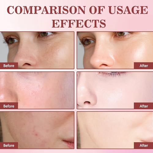 2Pcs Dragon Blood Retinol Cream, Dragons Blood Easy Cream, - Product Imagery