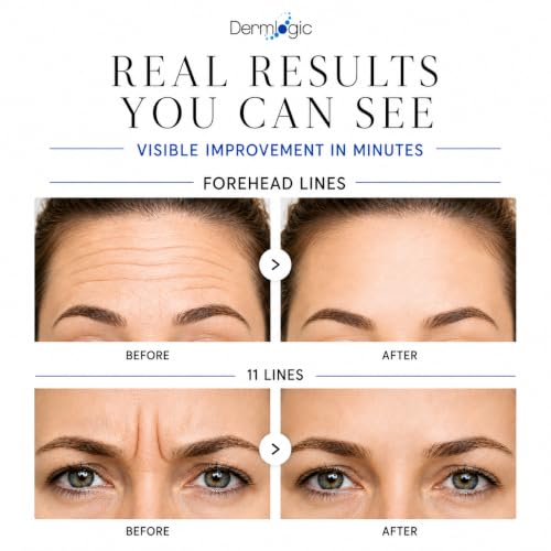 Under Eye Puffiness & Dark Circles Rapid Treatment- Instantly - Product Imagery