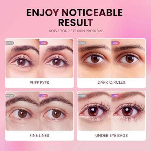Under Eye Patches (24 Pairs) - Tri-color Glitter Eye Gel Pads - Product Imagery