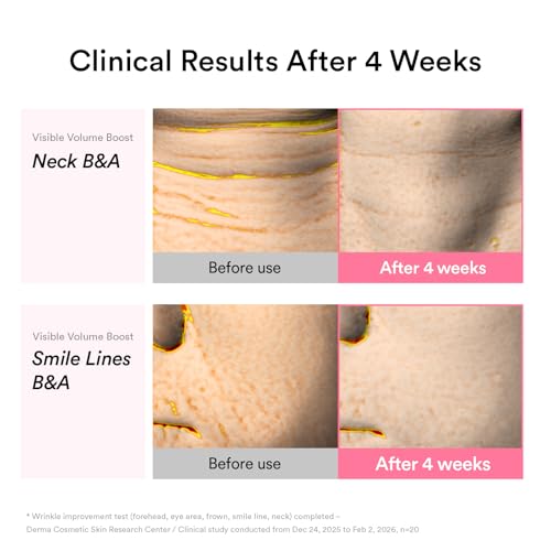 Abib PDRN Volume fill-it Booster Cream 2.5 tube | Volufiline - Product Imagery