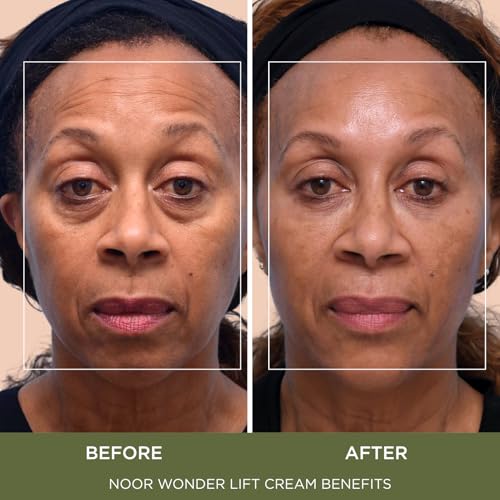 Noor Wonder Lift Cream for Women, Natural Anti-Aging Wrinkle - Product Imagery