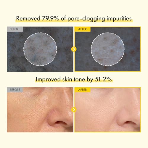 TOSOWOONG Kojic Acid Turmeric Face Wash for Brightening & Dark - Product Imagery